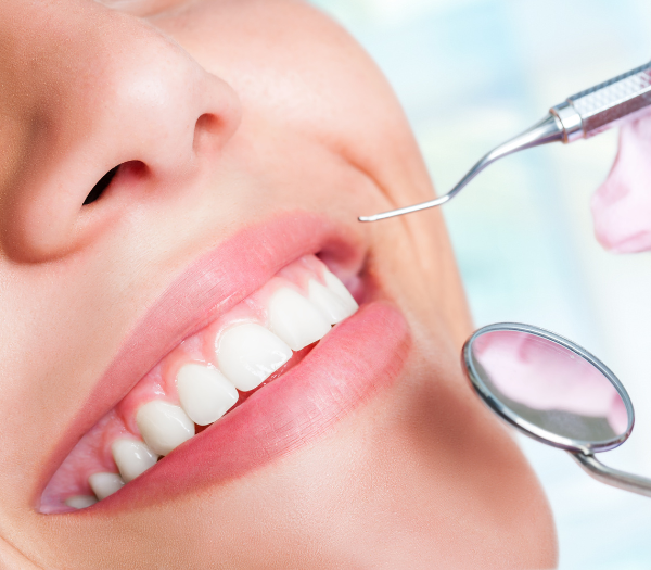 Implantes Dentales
